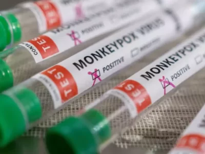 MONKEYPOX 1 1536x1024 1 873x432 1