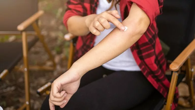 mosquito-bite_2167798851-768x432