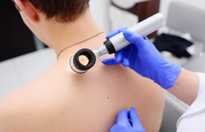 melanoma20181105.jpg