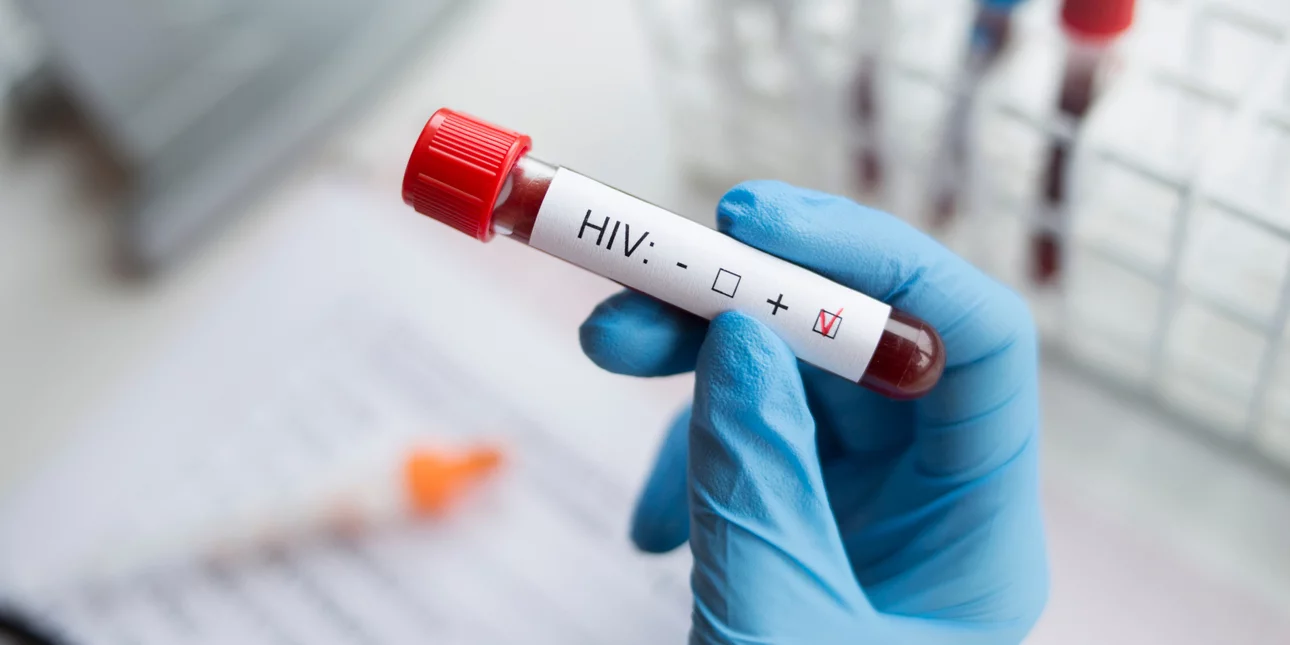 hiv-aids-16-1121.jpg