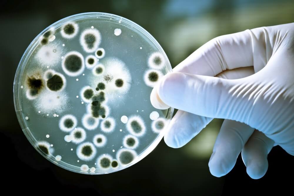 infectious-diseases