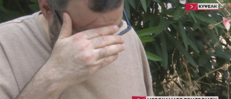 Κυψέλη - Μεροκάματο του τρόμου: Στον ΑΝΤ1 μιλά το θύμα της άγριας επίθεσης (βίντεο)