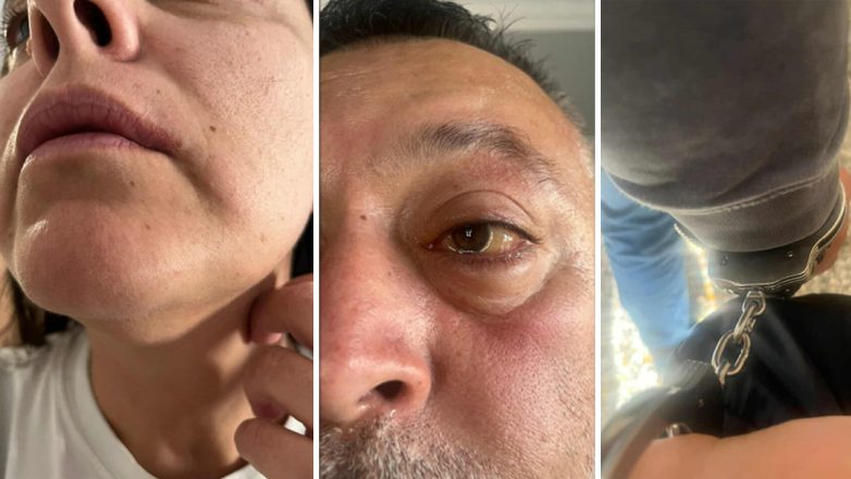 Έβαλαν χειροπέδες και κακοποίησαν ζευγάρι Τούρκων τουριστών γιατί μετέφεραν… τσιγάρα! Untitled-2_mesa-782x440 (1)