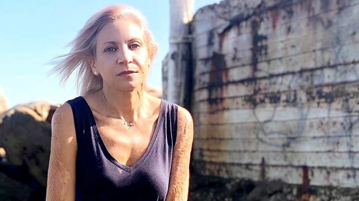 kalli_anagnostou_mati