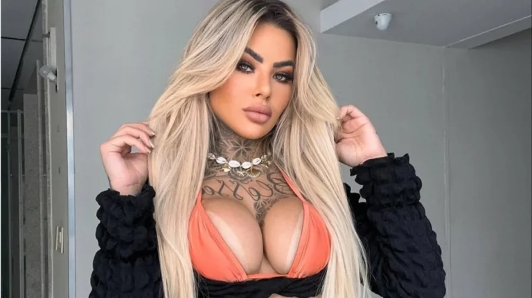 Νεκρή 27χρονη Βραζιλιάνα influencer μετά από επιπλοκές αισθητικής επέμβασης