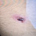 Αίγιο: Προθεσμία έλαβε ο 45χρονος που πυροβόλησε τους ανήλικους – Σοκάρουν τα τραύματα από τα σκάγια που δέχθηκε 15χρονος Αίγιο: Προθεσμία έλαβε ο 45χρονος που πυροβόλησε τους ανήλικους – Σοκάρουν τα τραύματα από τα σκάγια που δέχθηκε 15χρονος