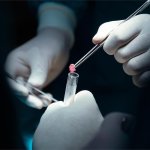 Κινδυνεύει 67χρονος από την Πάτρα γιατί καθυστέρησε η βιοψία – Καταγγελίες συγγενών στην «Πολιτεία», σε απόγνωση η οικογένεια